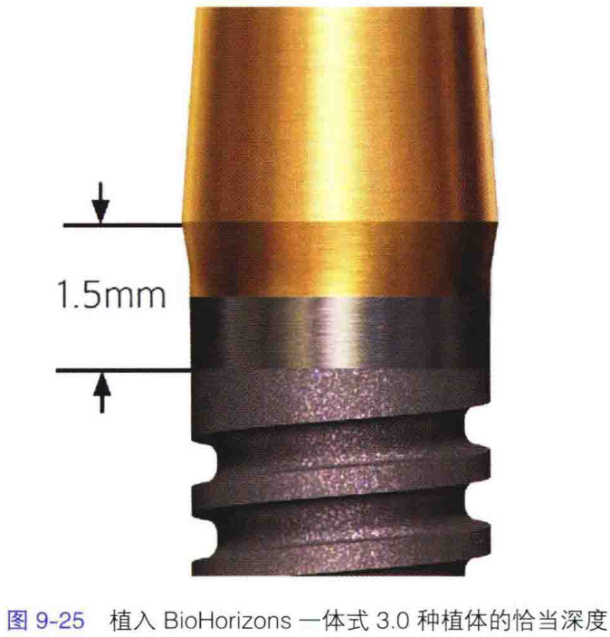 奥地利最新款植入体，医疗科技的革新先锋